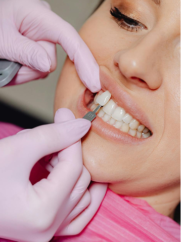 Rehabilitación Oral y estética dental